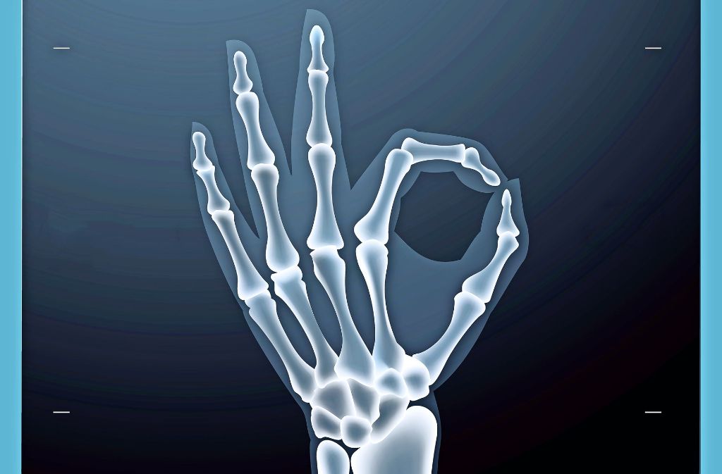 Röntgenbilder  erlauben  genauere Diagnosen. Trotzdem sollte man Nutzen und Risiken abwägen. Foto: Fotolia