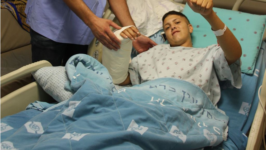 Geglückte Operation in Israel: 20-Jähriger trennt Arm mit Kreissäge ab – Ärzte nähen ihn an