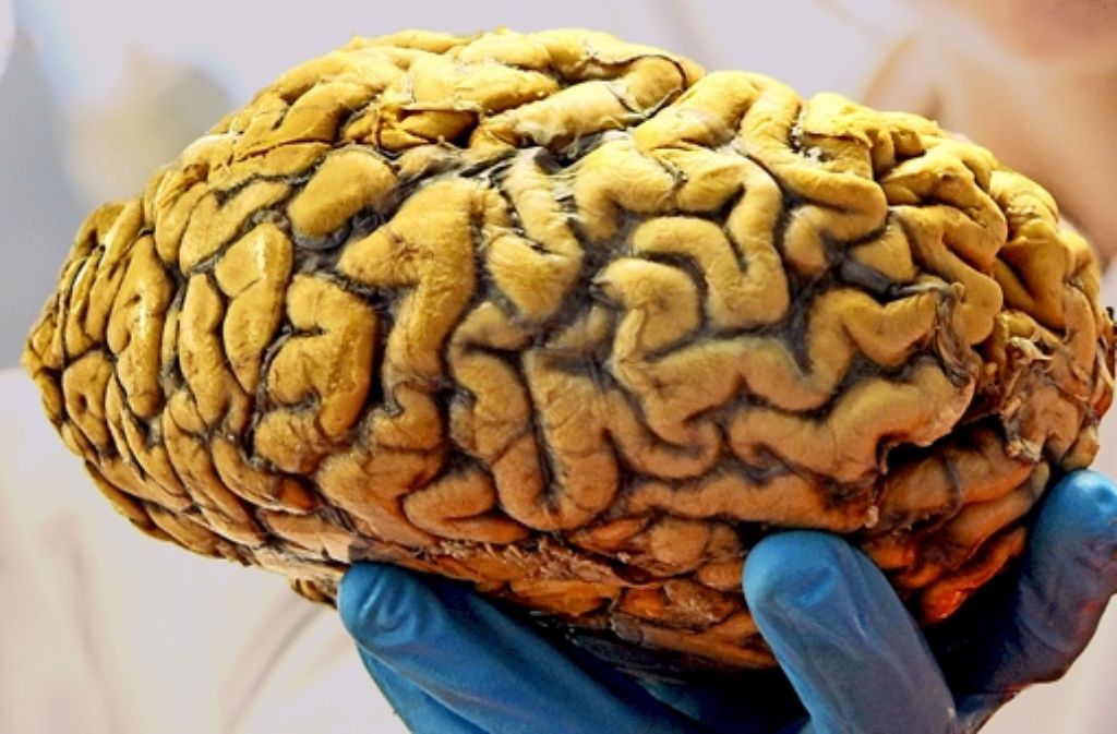 Veränderungen im Gehirn von Dementen können zu einem kriminellen Verhalten führen. Foto:  