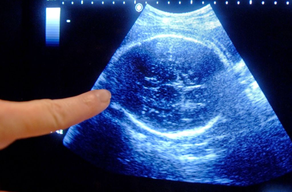 Laut dem umstrittenen Gesetz sollen Schwangerschaftsabbrüche ab dem Zeitpunkt strafbar sein, wenn Herztöne des Fötus gemessen werden können. (Symbolfoto) Foto: picture alliance / dpa
