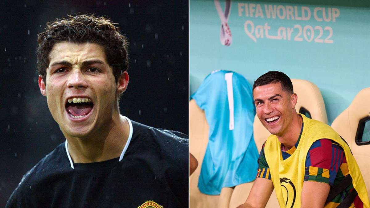 Christiano Ronaldos Zähne waren nicht immer so weiß und gerade wie heute.