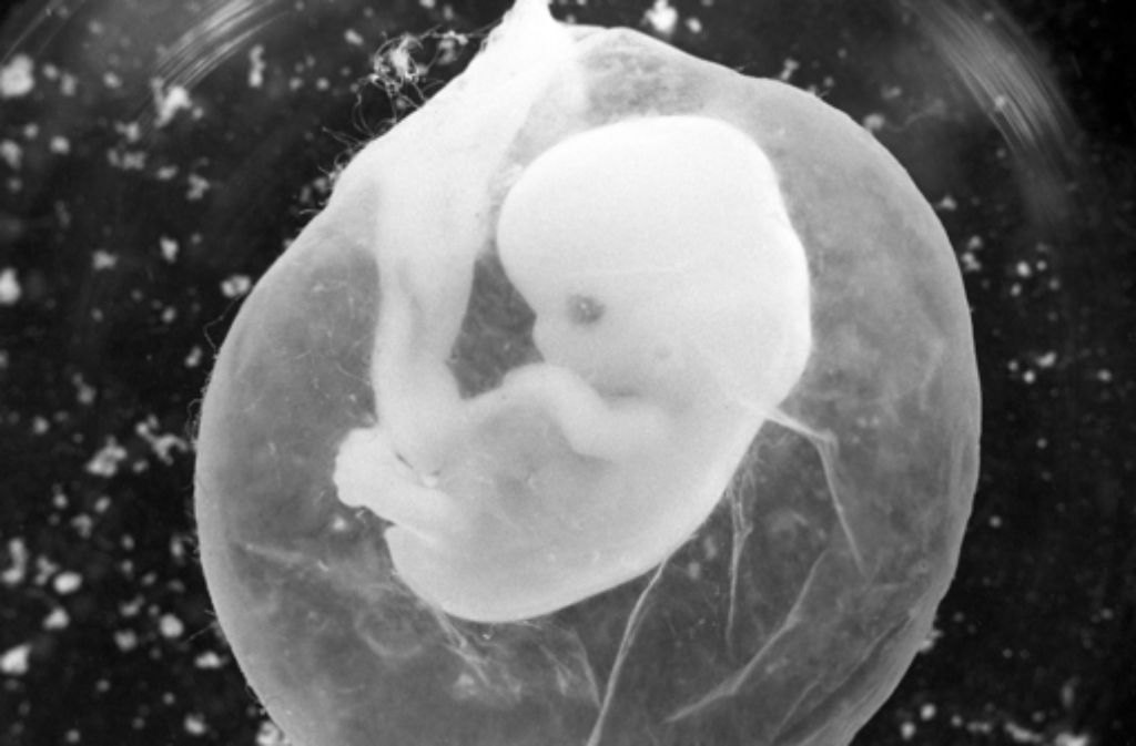 Ein Embryo in der Fruchtblase, mit der Mutter verbunden durch die Plazenta. Foto: dpa
