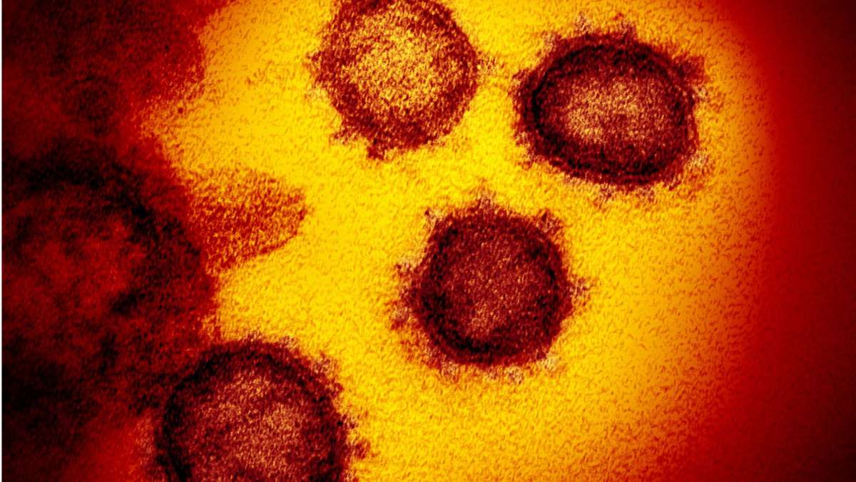  Das Corona-Virus ist ein Körper-Killer: Es schädigt Organe, Gewebe und Zellen. Was Sars-CoV-2 mit den Zellen macht und wie sie in „Virusfabriken“ umgewandelt und so zerstört werden, haben Heidelberger Wissenschaftler untersucht. 