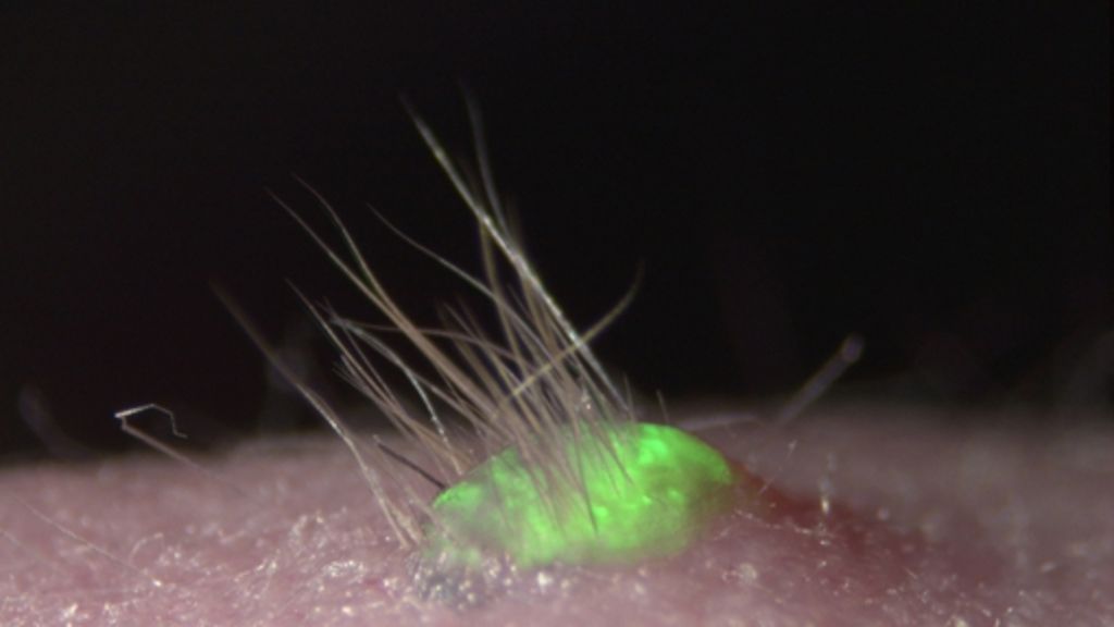 Medizin: Haut mitsamt Haaren künstlich produziert